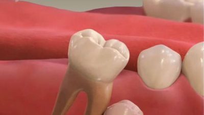 Rüyada diş çıkması ile ilgili temel anlamlar, psikolojik etkiler, kültürel