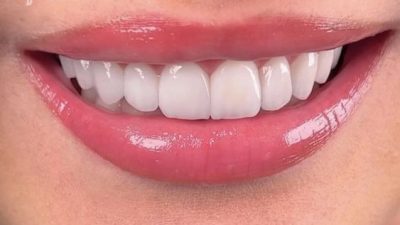 Rüyada diş görmek, çeşitli yorumları ve psikolojik etkileri ile birlikte