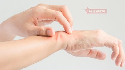 İki elin parmaklarının kaşınması hakkında halk inanışları, bilimsel gerçekler ve