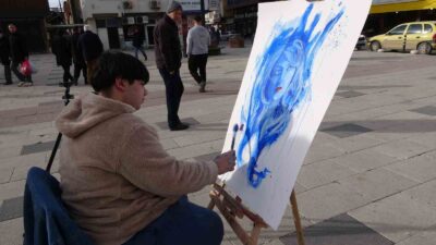 Yozgat’ın Sorgun ilçesinde yaşayan yürüme ve konuşma engelli Enes Külekçi,