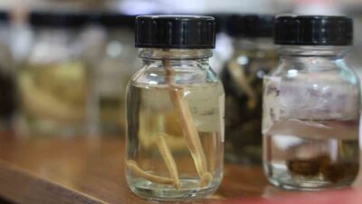 Prof. Dr. Naim Sağlam, tıbbi sülüklere dair doğru bilgileri paylaştı.