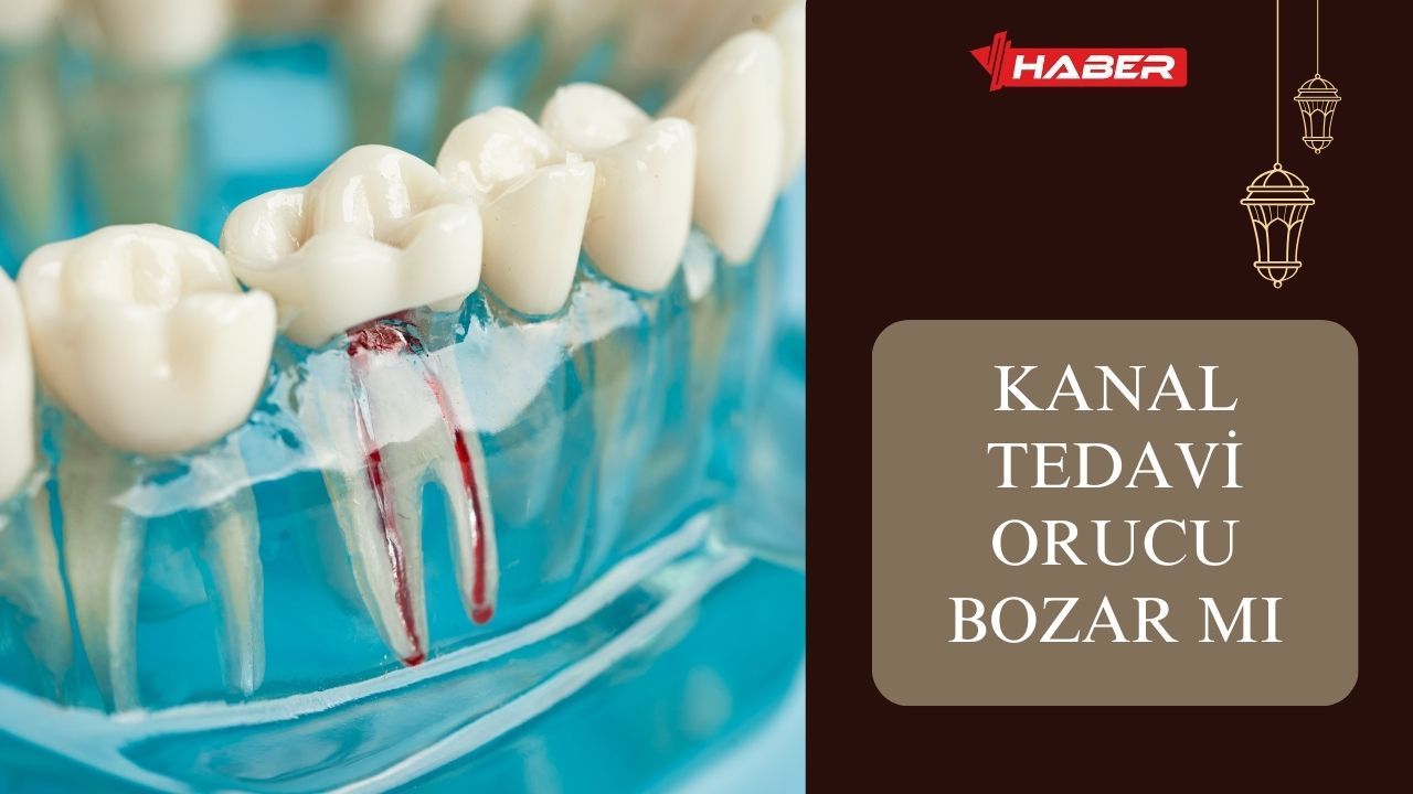 Kanal Tedavisi Orucu Bozar Mı