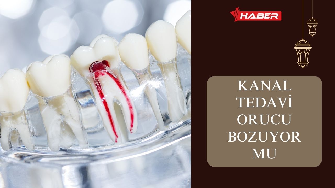 Kanal Tedavisi Orucu Bozar Mı