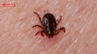 Kene ısırığı belirtileri nelerdir, kene ısırığında ne yapılmalı? Yaz aylarında