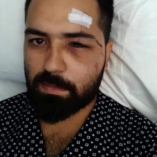 Ankara'da yaşayan 15 Temmuz Gazisi Muhammed Musa Akkoç, darbeci askerlerle