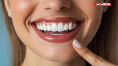 Diş estetiği son yıllarda sadece sağlık açısından değil, estetik açıdan