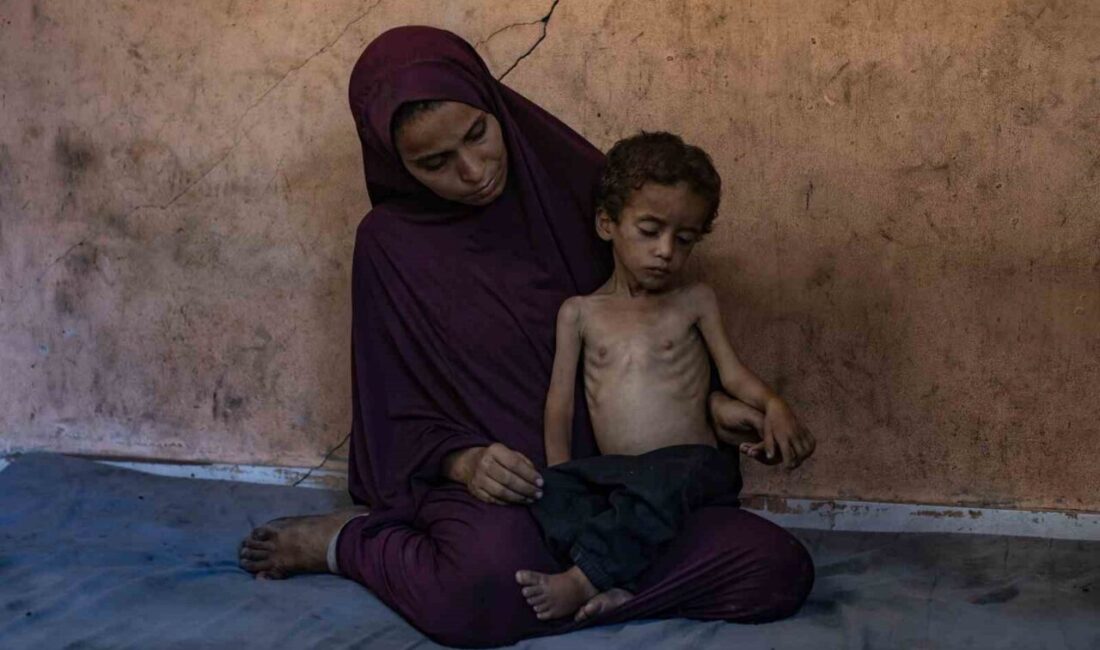 Gazze'de açlık krizi derinleşiyor: 113 kişi açlıktan hayatını kaybetti. Bölgede