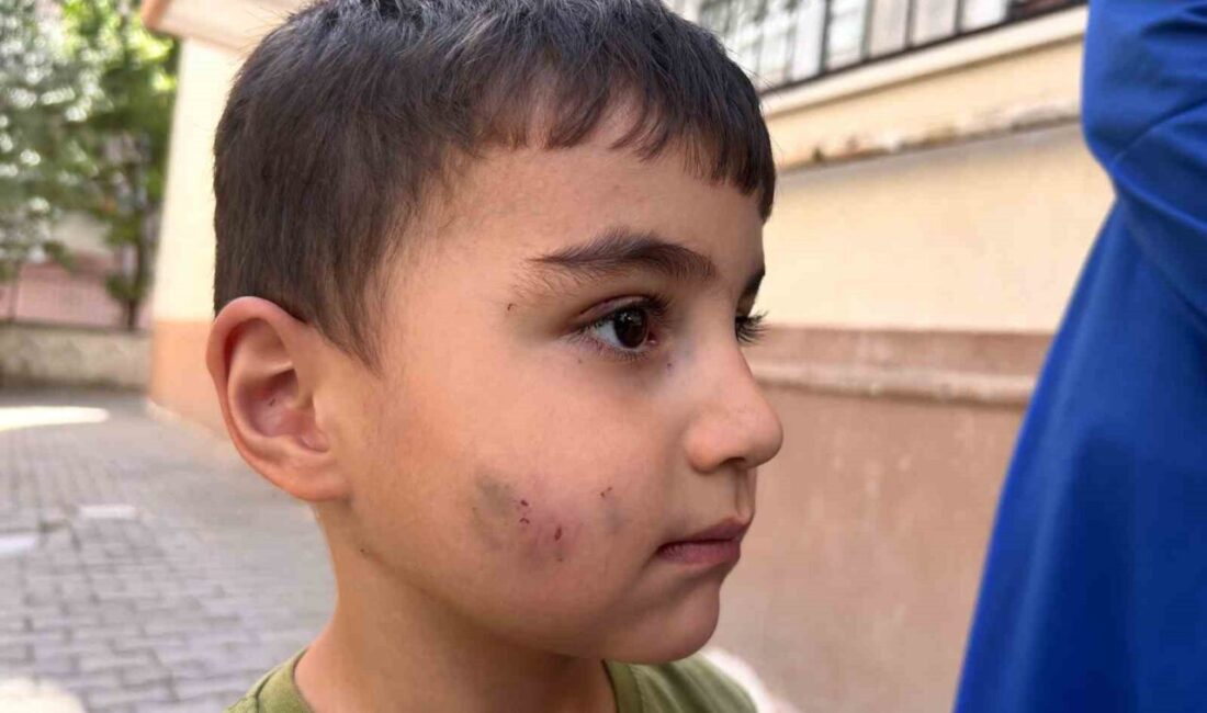 Ankara Sincan'da lağım faresi tarafından ısırılan çocuğa kuduz aşısı yapıldı.