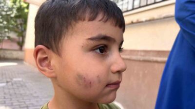 Ankara Sincan'da lağım faresi tarafından ısırılan çocuğa kuduz aşısı yapıldı.