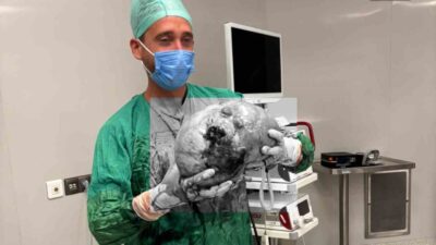 Yozgat Şehir Hastanesi'nde ameliyat olan 70 yaşındaki kadının karın ağrısı