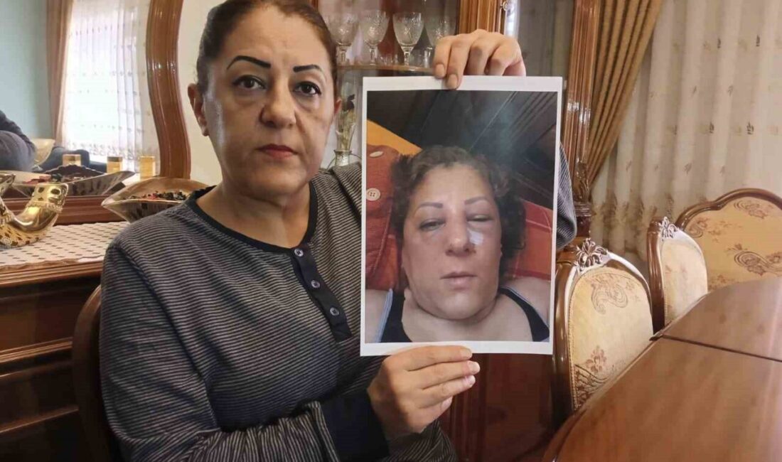 Ankara'da komşularıyla kediler yüzünden husumet yaşayan Nihal Aras, yaşadığı şiddet