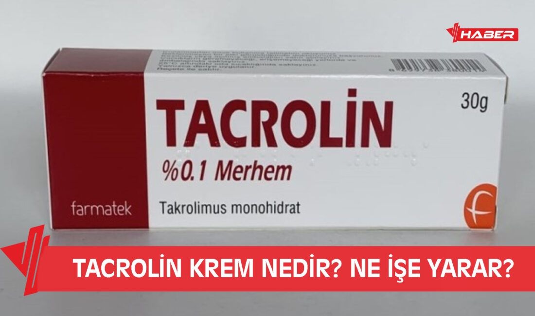 Tacrolin krem, egzama ve özellikle atopik dermatit tedavisinde kullanılan, kortizon