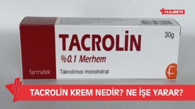 Tacrolin krem, egzama ve özellikle atopik dermatit tedavisinde kullanılan, kortizon