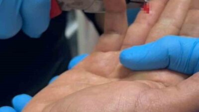 Adıyaman’ın Kahta ilçesinde balık avlamak için göle giden bir kişinin