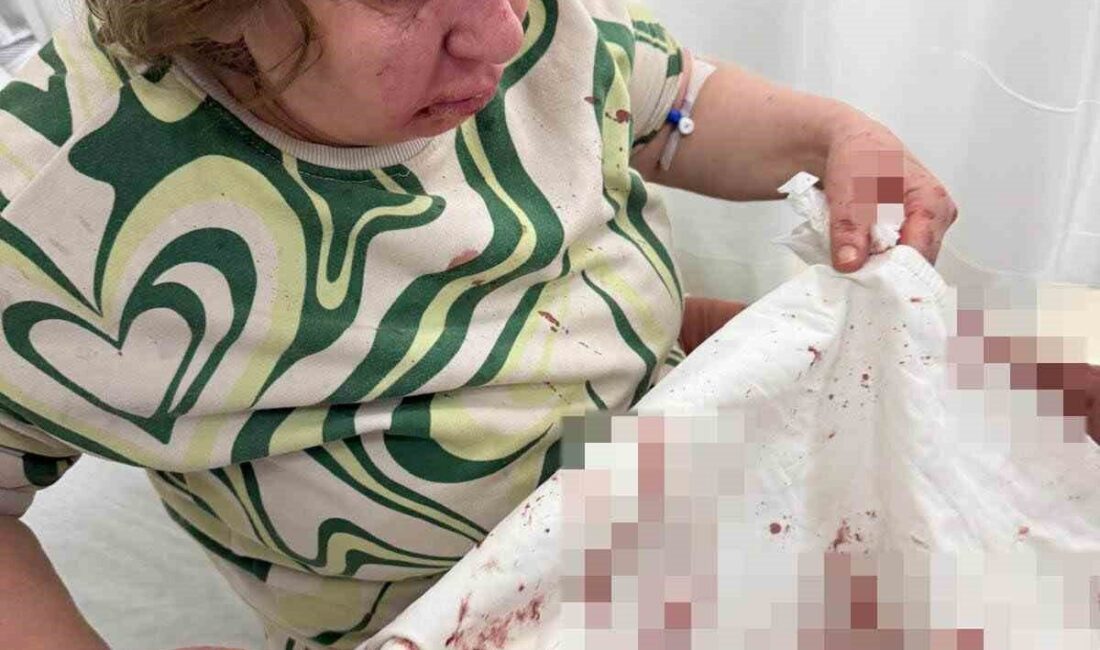 Denizli’nin Sarayköy ilçesinde gürültü sebebiyle çıkan komşu anlaşmazlığı şiddetle sonuçlandı.