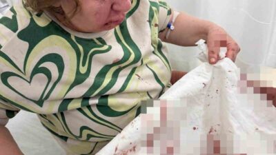 Denizli’nin Sarayköy ilçesinde gürültü sebebiyle çıkan komşu anlaşmazlığı şiddetle sonuçlandı.