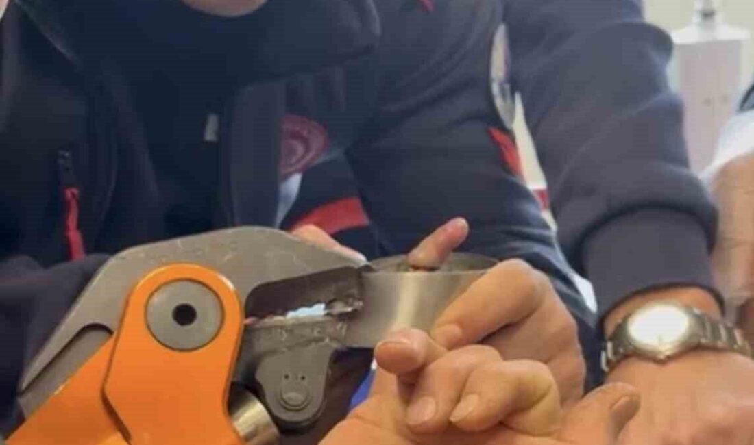 Elazığ’da, çelik bir küllüğün deliğine sıkışan 1 yaşındaki bir bebeğe