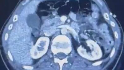 Kayseri İl Emniyet Müdürlüğü ekipleri tarafından gerçekleştirilen operasyonda, İran’dan Türkiye’ye