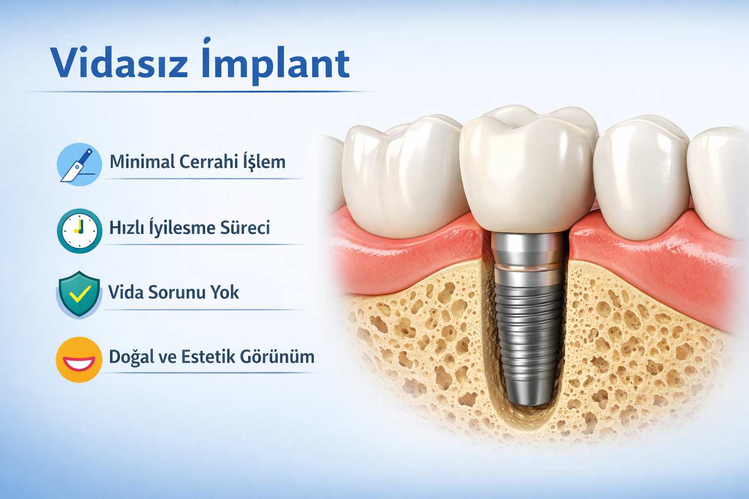 vidasız diş implantı
