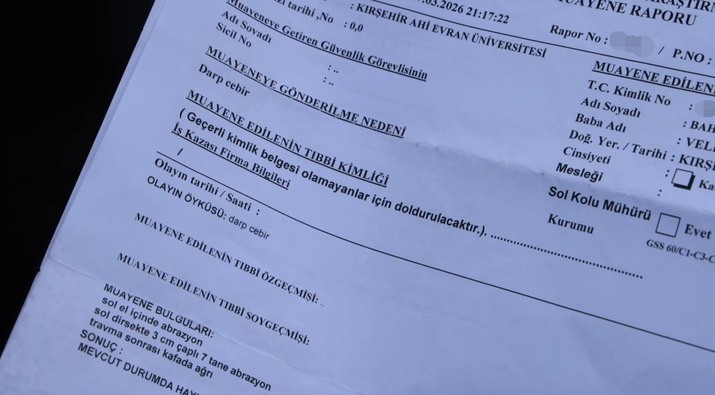 Kırşehir’in Özbağ Belde Belediye Başkanı İsmail Çanakçı’nın bir şizofreni hastasını