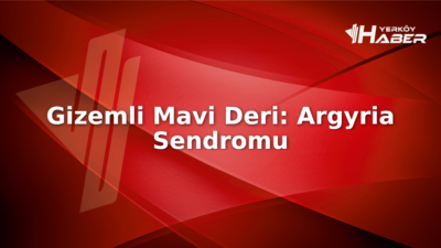 Hastaneyi alarma geçiren mavi deri: Argyria sendromu ve gümüş zehirlenmesi