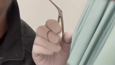 Kayseri’de polis ekipleri, kulağında uyuşturucu madde bulunduran bir şüpheliyi gözaltına
