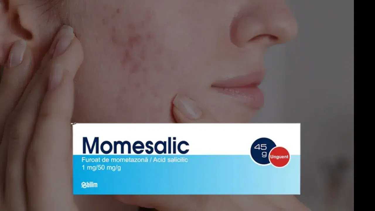 Momesalic krem nedir, neye yarar ve nasıl kullanılır? - Yeni Birlik