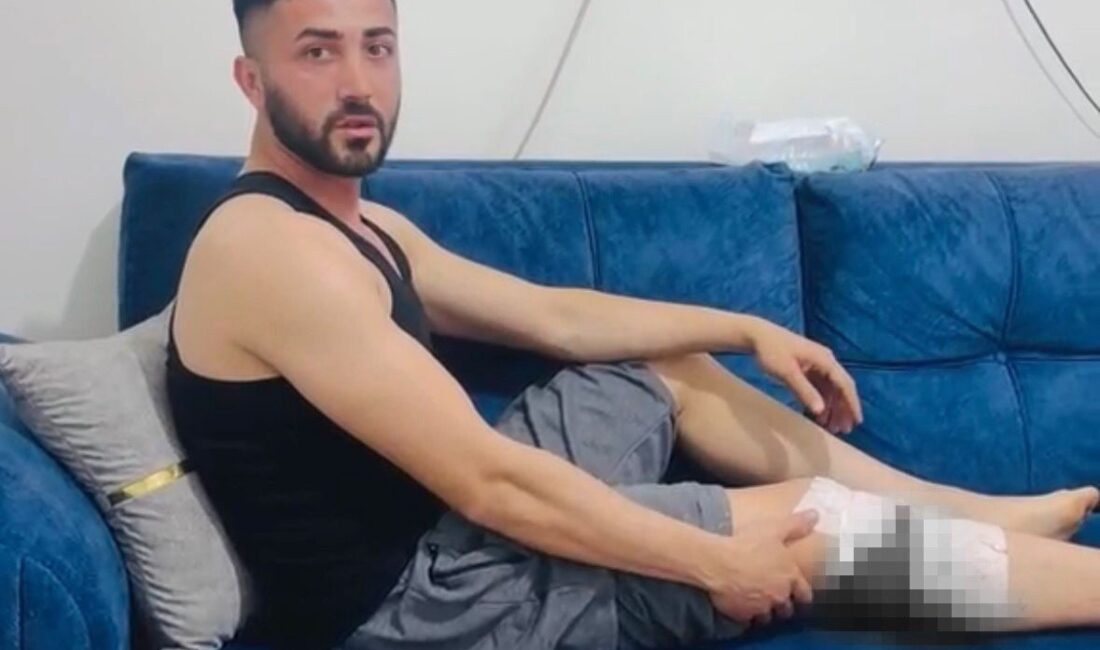 Gaziantep’in Nizip ilçesinde, sokak köpeklerinin saldırısına maruz kalan 2 kişi