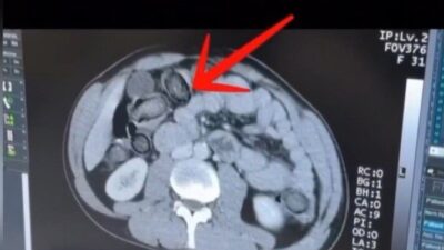 Erzincan’da gerçekleştirilen narkotik operasyonunda 983,18 gram metamfetamin ele geçirildi ve