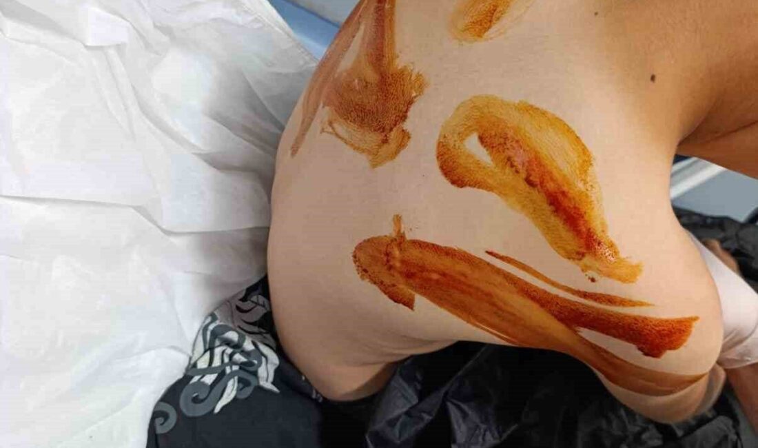 Eyyübiye ilçesinde yaşanan olayda, 17 yaşındaki bir genç, iddiaya göre