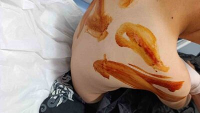 Eyyübiye ilçesinde yaşanan olayda, 17 yaşındaki bir genç, iddiaya göre