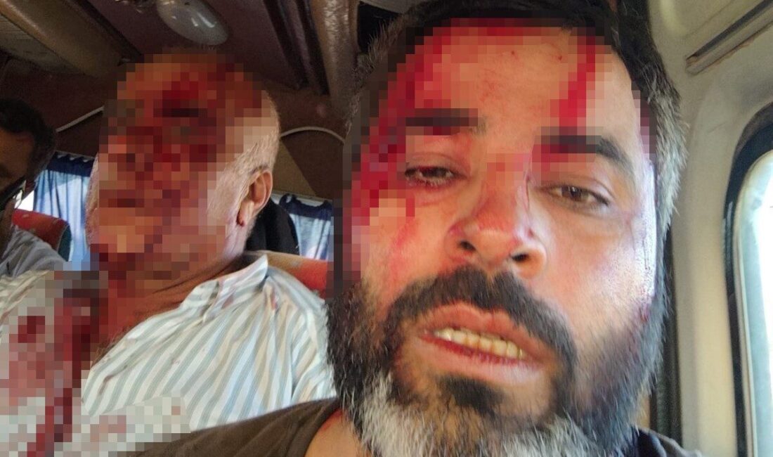 Şanlıurfa’nın Akçakale ilçesinde iki grup arasında arazi anlaşmazlığı nedeniyle çıkan