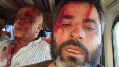 Şanlıurfa’nın Akçakale ilçesinde iki grup arasında arazi anlaşmazlığı nedeniyle çıkan