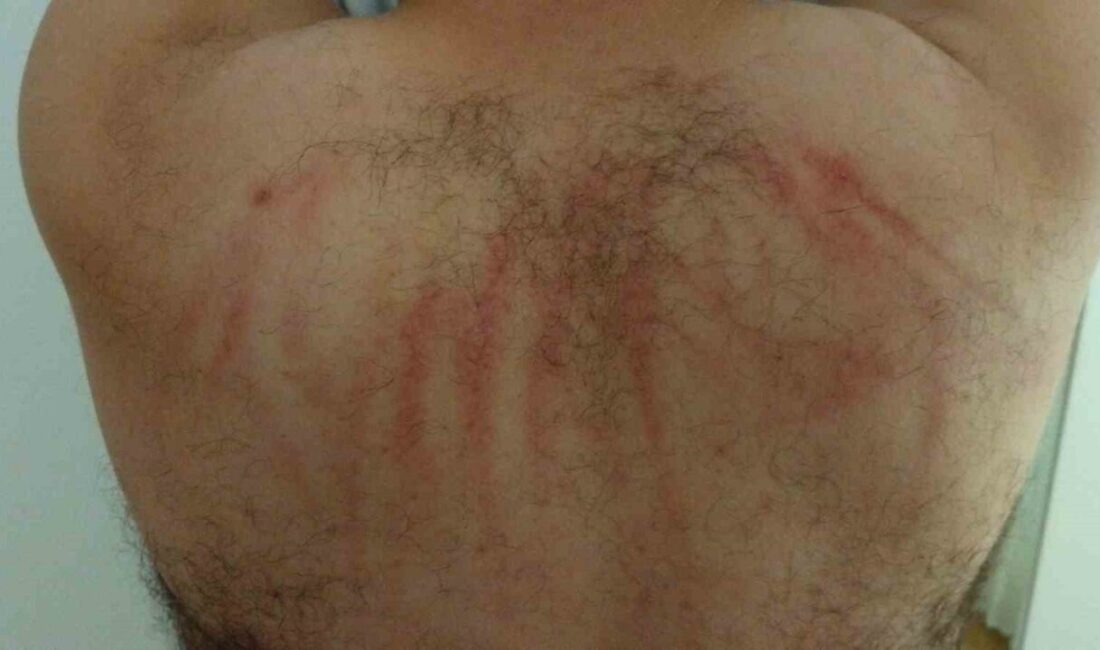 Samsun’da 3 çocuk babası bir adam, evinin önünde 3 kişinin