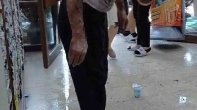 Bursa’da bir işhanında lavabo tıkanıklığını açmak amacıyla kullanılan güçlü kimyasal