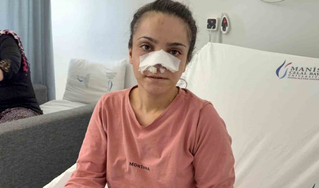 Manisa’nın Turgutlu ilçesinde, eşi tarafından darp edilerek burnu ısırılıp koparılan