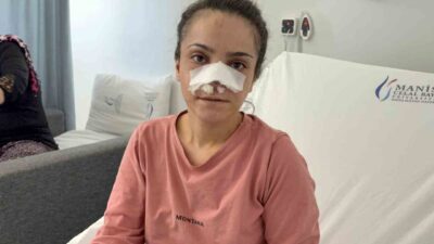 Manisa’nın Turgutlu ilçesinde, eşi tarafından darp edilerek burnu ısırılıp koparılan
