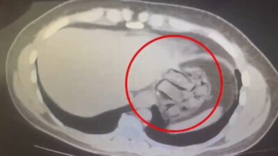 Kars’ta gerçekleştirilen bir operasyonda, İran vatandaşı olduğu düşünülen bir kurye