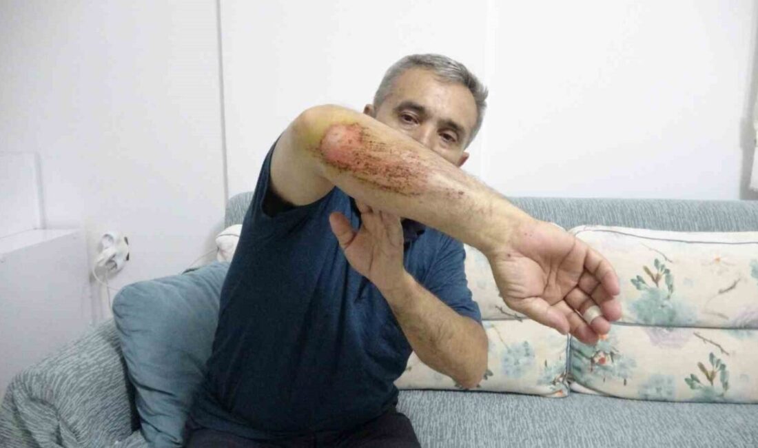 Isparta’da, otizmli oğlu Emrecan Dikyar’la motorla gezerken çoban köpeklerinin saldırısına