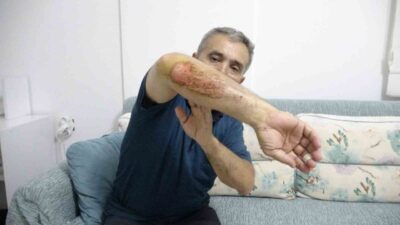 Isparta’da, otizmli oğlu Emrecan Dikyar’la motorla gezerken çoban köpeklerinin saldırısına