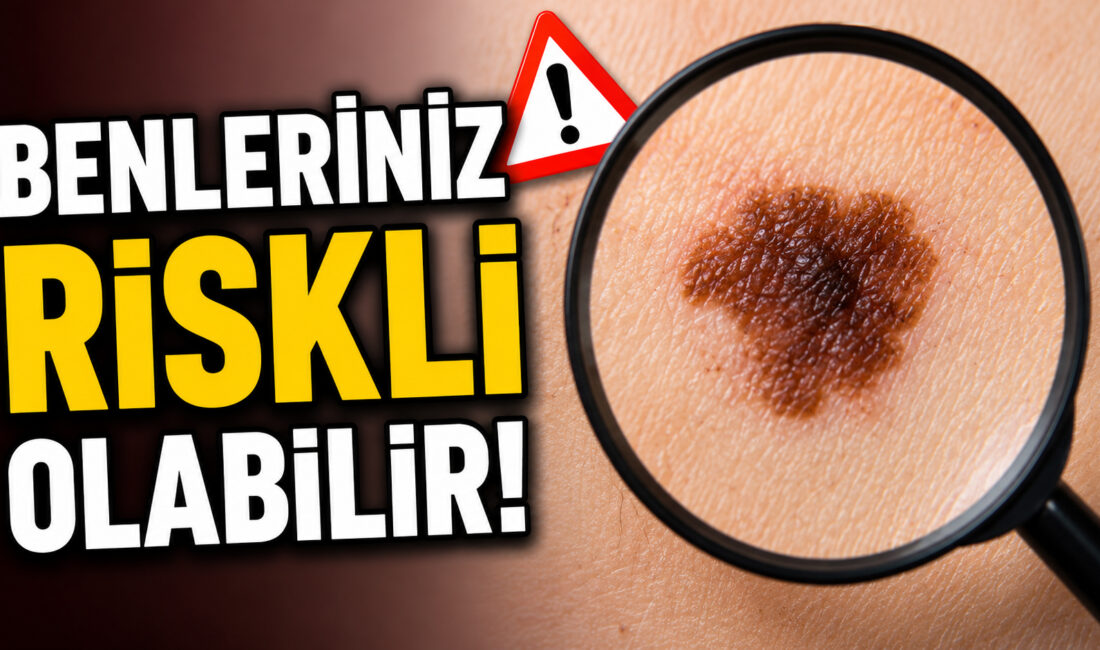 Cilt sağlığına dikkat çekmek amacıyla Sağlık Bakanlığı Sağlığın Geliştirilmesi Genel
