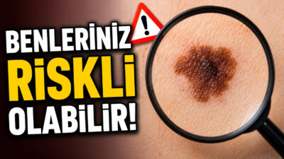 Cilt sağlığına dikkat çekmek amacıyla Sağlık Bakanlığı Sağlığın Geliştirilmesi Genel