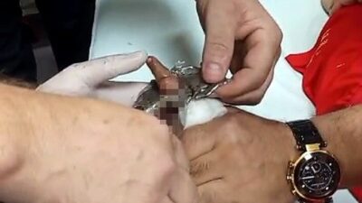 Bitlis’te, babasıyla bir lokantaya giden bir çocuğun oyun oynarken parmağı,