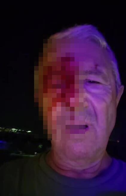 Kocaeli’de bir muhabir, haber takibi için gittiği olay yerinde iki