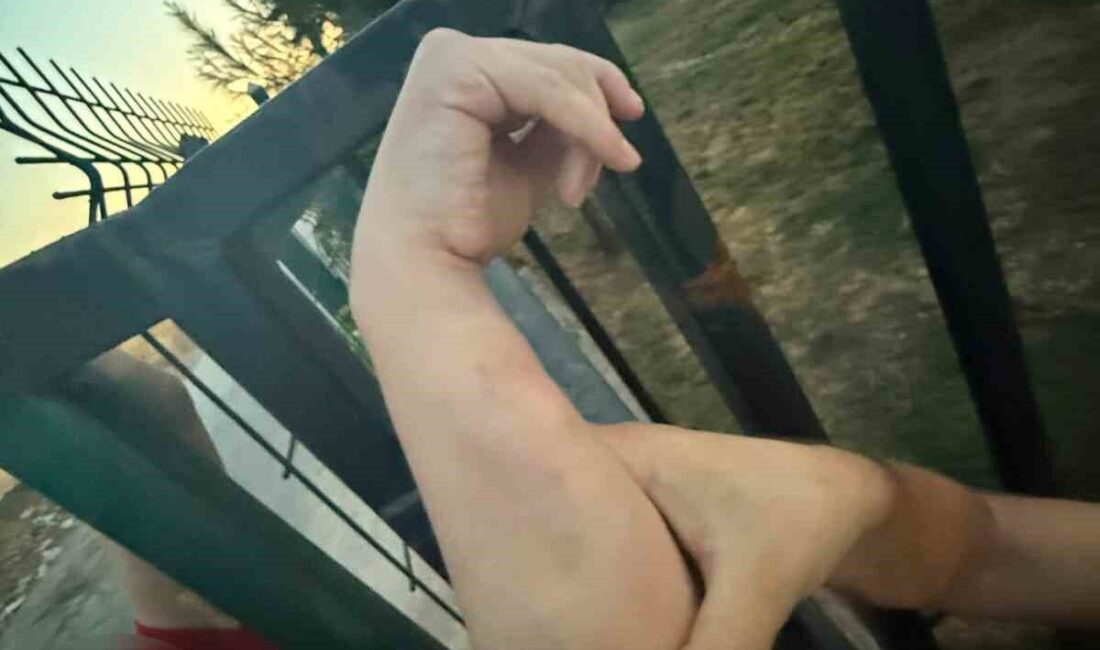 Batman’da, bir vatandaşın kolunun bahçe girişindeki demir korkuluklara sıkışması sonucu