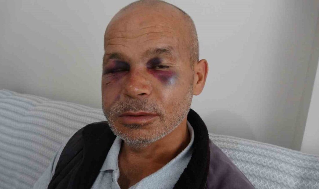 Konuşma ve işitme engelli bir adamın Adana’nın Kozan ilçesinde darp