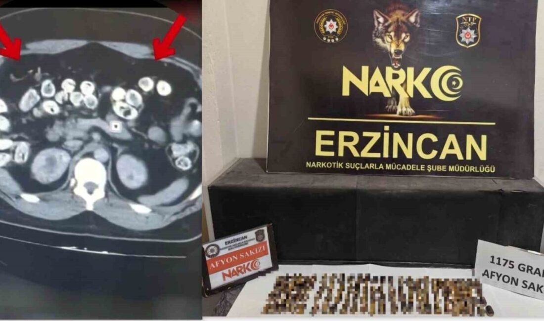 Erzincan’da, mide ve bağırsaklarında kapsül şeklinde uyuşturucu bulunan 3 şüpheli