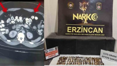 Erzincan’da, mide ve bağırsaklarında kapsül şeklinde uyuşturucu bulunan 3 şüpheli