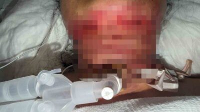 Antalya’da yaşayan ve 2 çocuk annesi emlakçı Gonca Uzhan, gıdı
