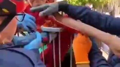 Adana’da bir çocuk, oyun sırasında koluna korkuluk demiri saplanması sonucu
